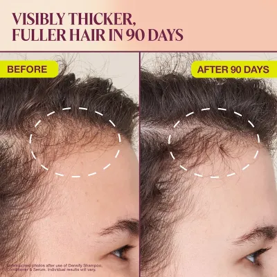 Full Routine Pack – Complete Fermented Hair Wellness System | Amare