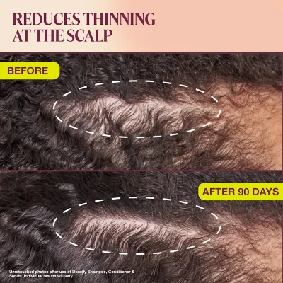 Full Routine Pack – Complete Fermented Hair Wellness System | Amare